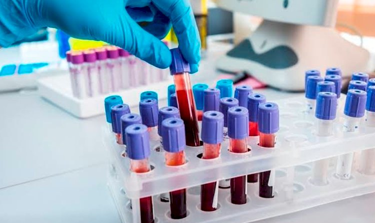 Precisando de exames de laboratórios pelo SUS? Se liga nessa ação!