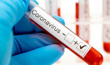 Exames de covid-19 estão disponíveis no site da Secretaria Municipa de Sáude.